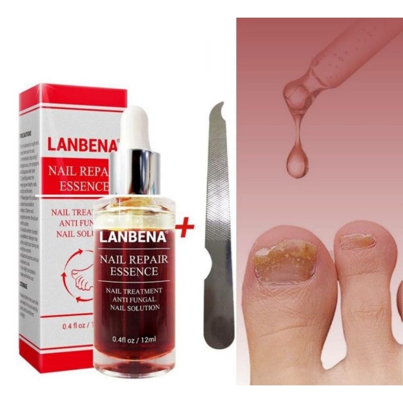 Lanbena serum kuku essence oil labena serum kuku untuk kuku jamuran nailart manicure pedicure nail