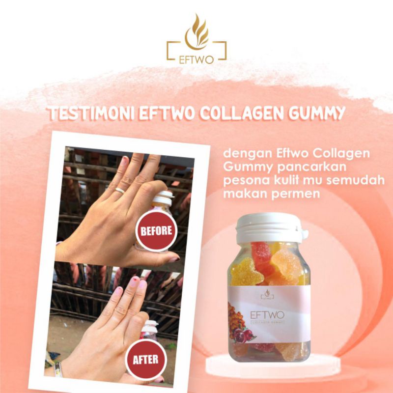 EFTWO GUMMY PERMEN COLLAGEN by EFTWO GLOW Original 1000%