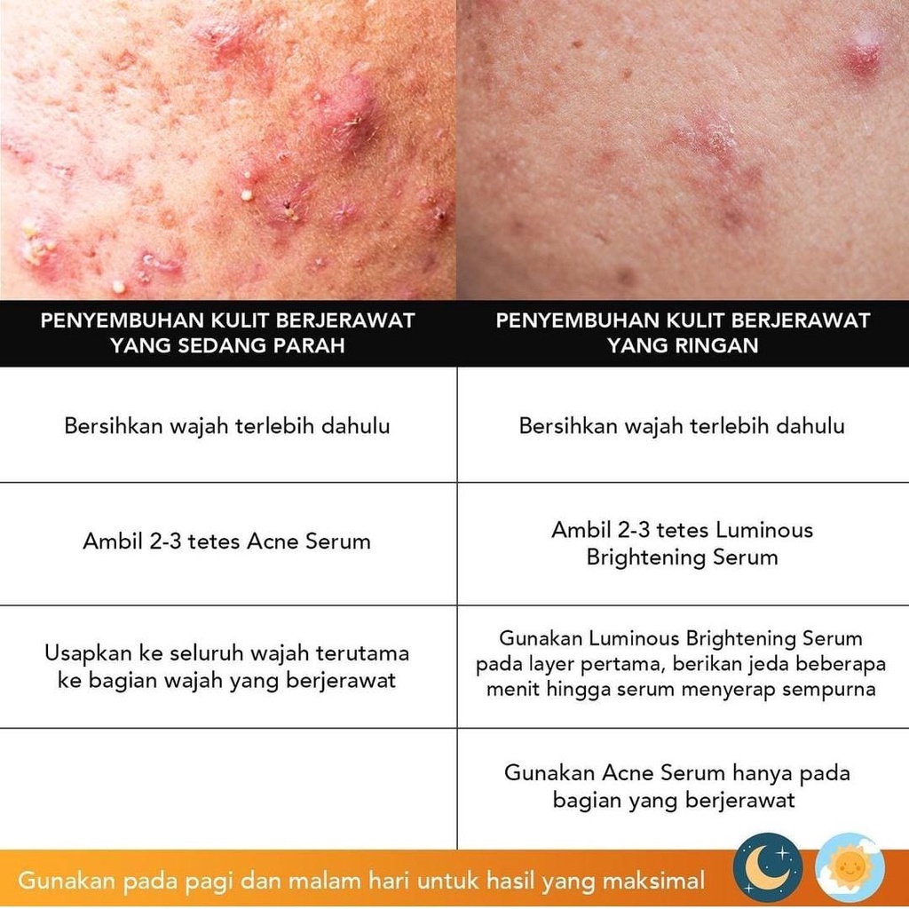 IMPLORA Face Serum / Serum Wajah Acne / Brightening / Peeling / Midnight Serum BPOM / Skin Care Skincare (VH)