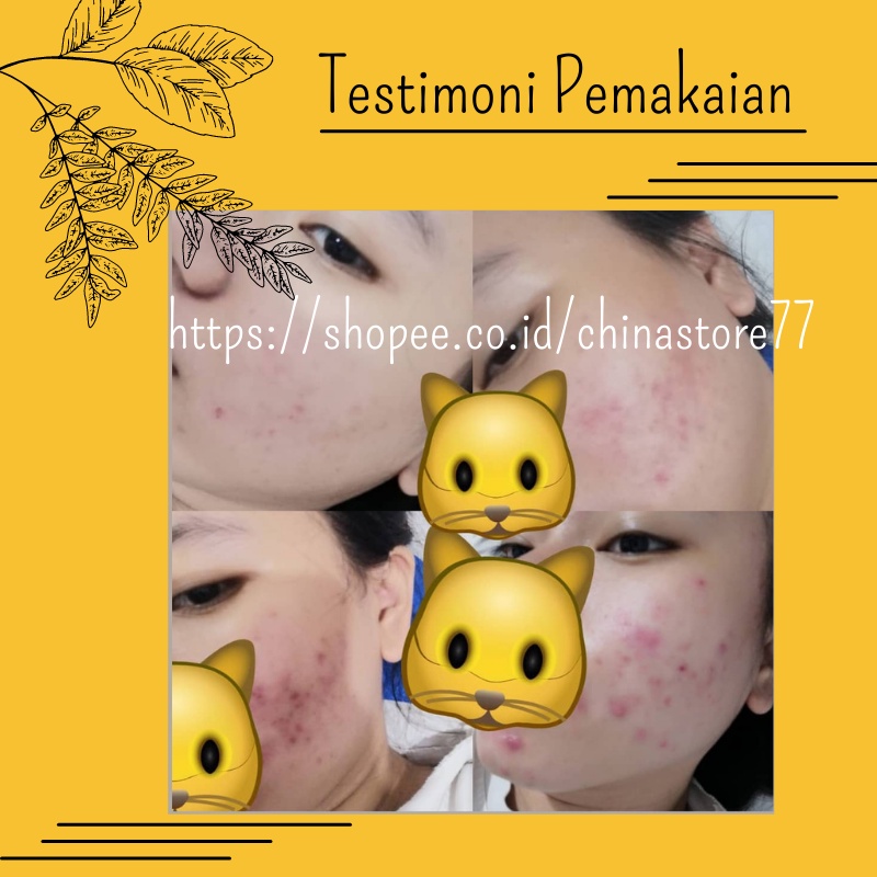 Serum Bopeng Wajah Penghilang  Bekas Jerawat Flex Hitam Bruntusan Bintik Hitam Stretch Mark TAMANU OIL 5ml Falabell  BPOM Oil