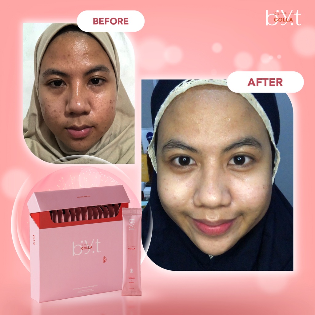 Byt Colla Ecer (1 Sachet) Eceran Sachetan Satuan / Minuman Kolagen Vitamin Kulit Cantik Cerah Glowing dan Sehat / Collagen Beauty Drink by Byoote Group