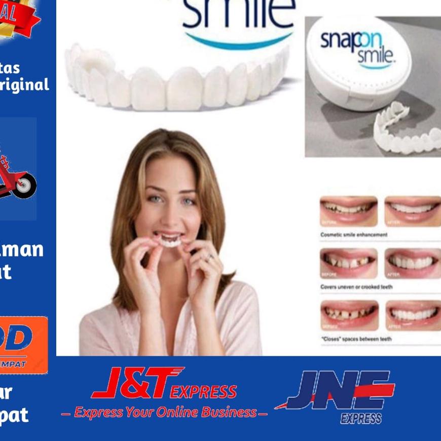 ♞ Snap On Smile ♙