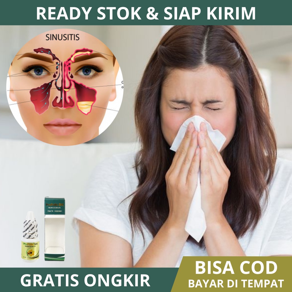 Obat Penyakit Sinusitis, Sinusitis Menahun, Sinusitis Akut, Sinusitis Kronis, Radang Sinus, Hidung T