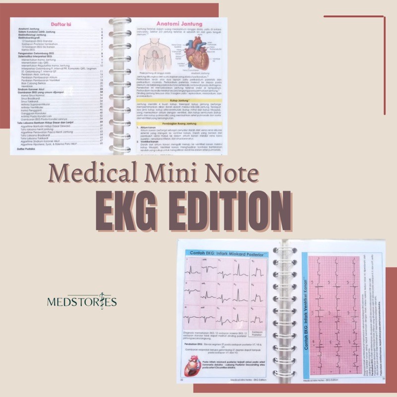 MMN EKG | ECG NOTES | MEDICAL MINI NOTES | MEDSTORIES