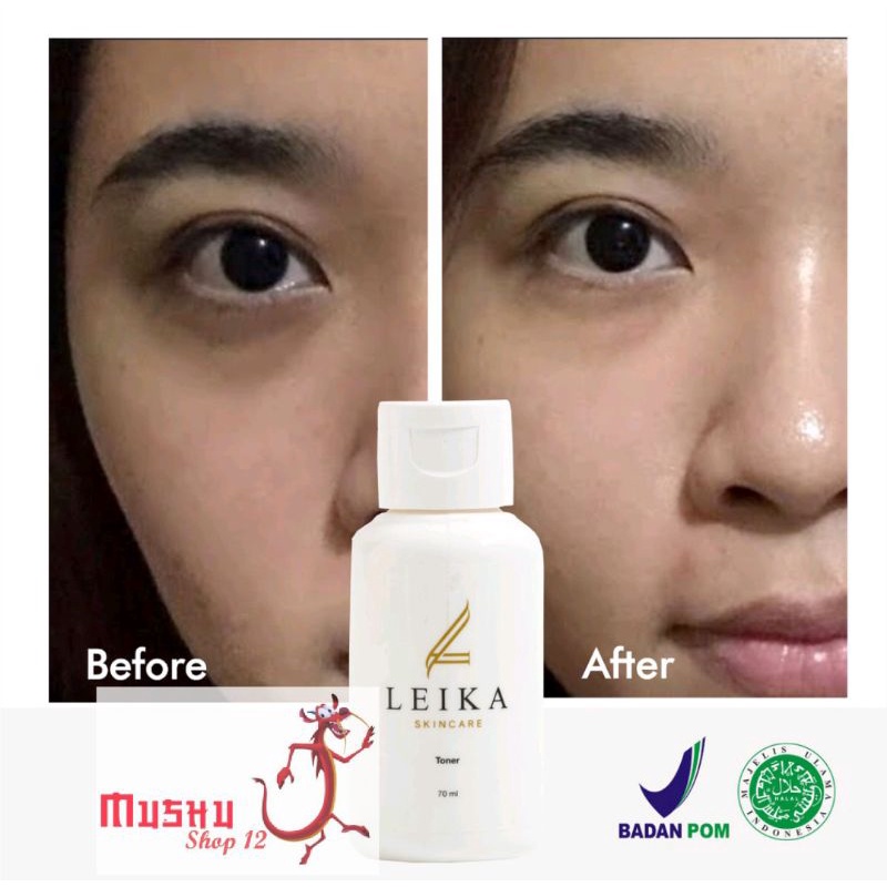 dv-TONER Leika Skincare / Toner Wajah Ketika / Skincare
