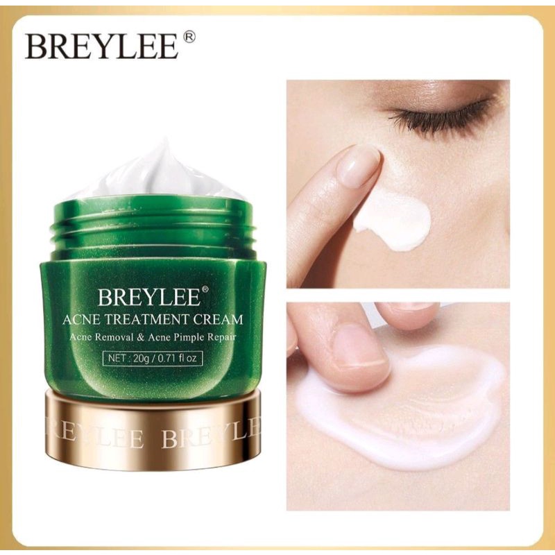 BREYLEE ACNE TREATMENT CREAM 20gr