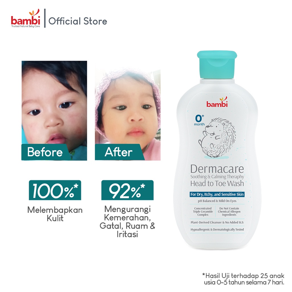 Bambi Baby Dermacare Daily Soothing &amp; Calming Therapy Head To Toe Wash 200ml | Sabun &amp; Shampoo Bayi Anak Khusus Kulit Atopic / Eczema / Eksim / Sabun Hypoallergenic | Sabun PH Balance Bayi