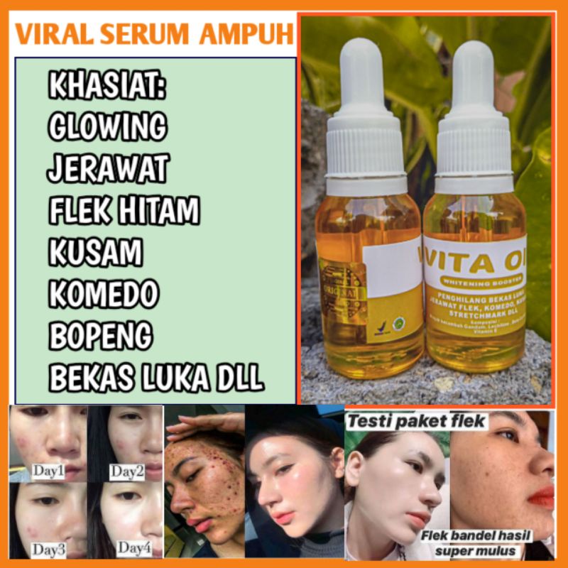 VITA OIL SERUM TERBAIK DUNIA ASLI [ TERBUKTI AMPUH]