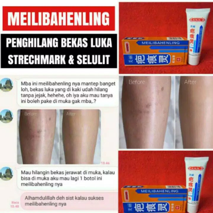 CREAM MEILIBAHENLING 40GR - PENGHILANG BEKAS LUKA BPOM