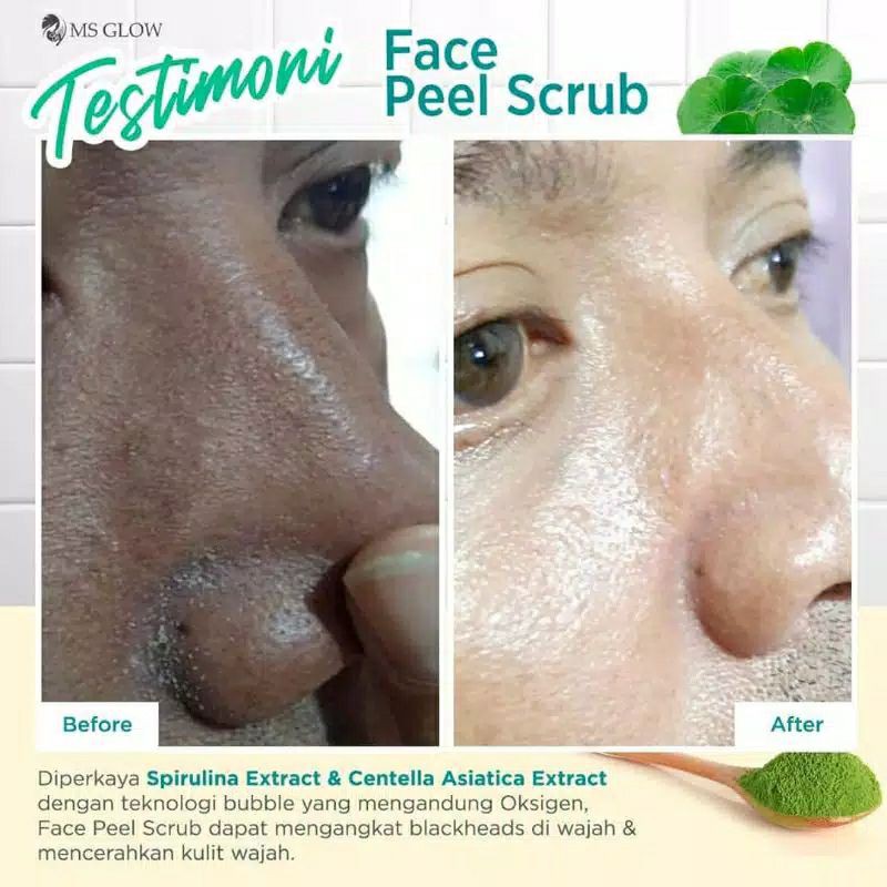 MS Glow Face Peel Scrub Wajah Aman BPOM Penghilang Keriput Wajah/ Mata Panda Pemutih Pencerah Wajah