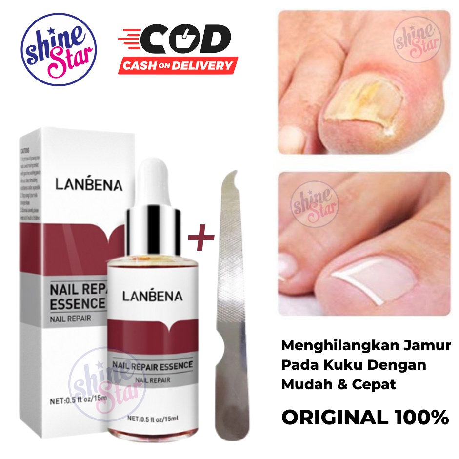 SHINE STAR - LANBENA Nail Repair Perawatan Esensi Serum Jamur Kuku Essence Oil Serum Nail Treatment