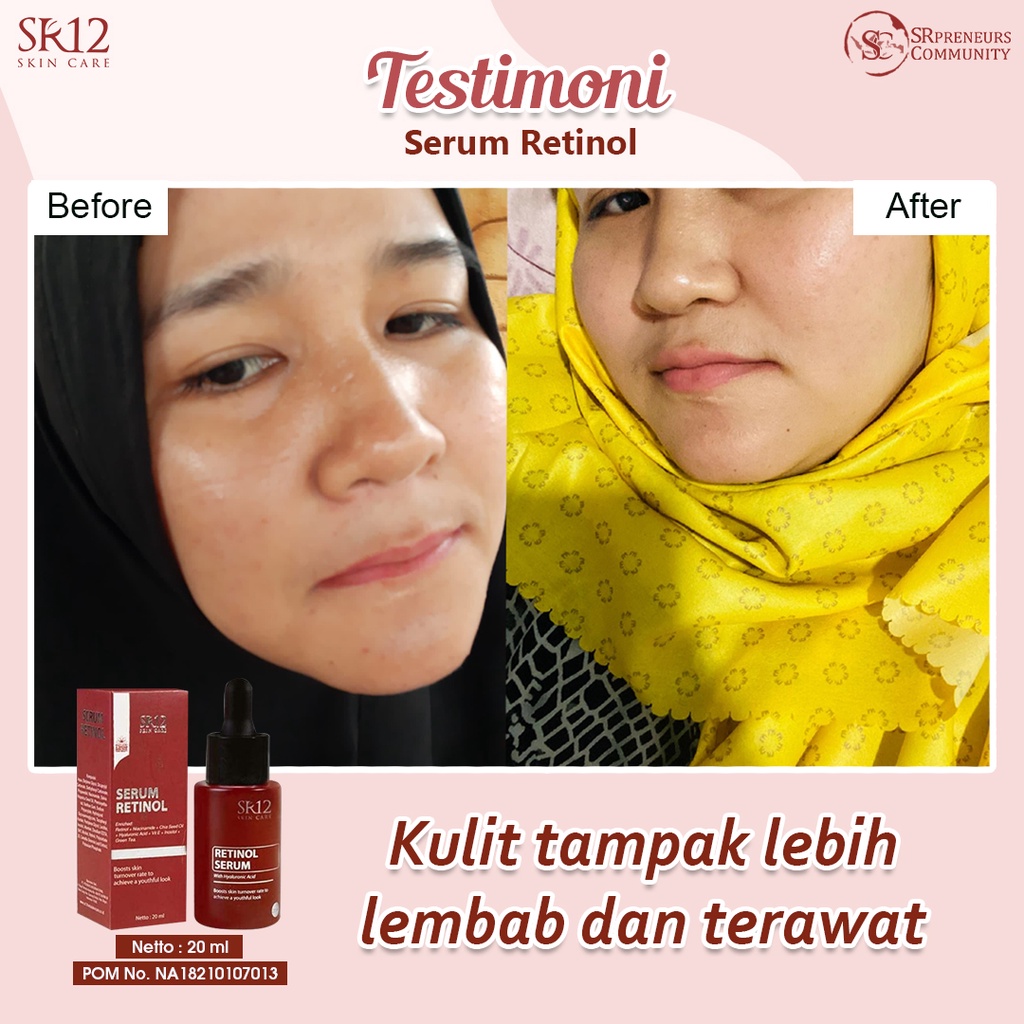 RETINOL SERUM SR12 / RETINOL 0,1% / ANTI AGING / MENCEGAH PENUAAN DINI / MENGATASI JERAWAT / MENCERAHKAN KULIT WAJAH