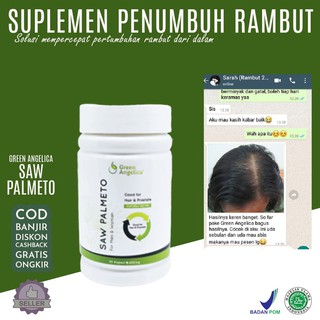  Terbaik  Kapsul Penumbuh Rambut  Cepat Aman  dan  BPOM 