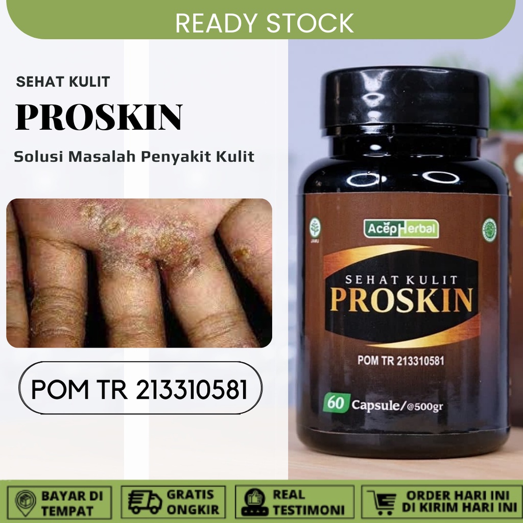 Obat Budug Atau Skabies Budug Di Kaki Budug Bernanah Budug Cenang, Gudik Di Kaki Budug Santri dan Ga