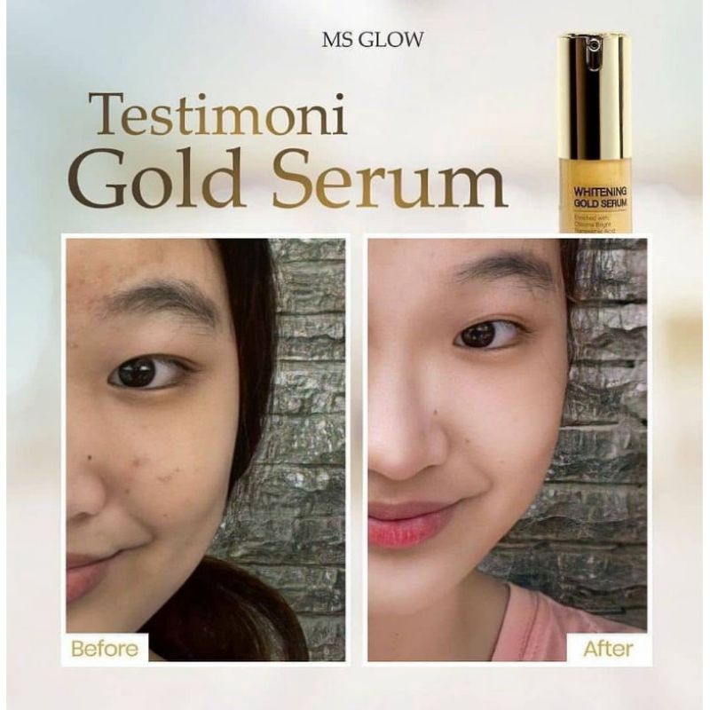 SERUM WHITENING GOLD ORIGINAL MS GLOW (SUDAH BER BARCODE TERBARU)