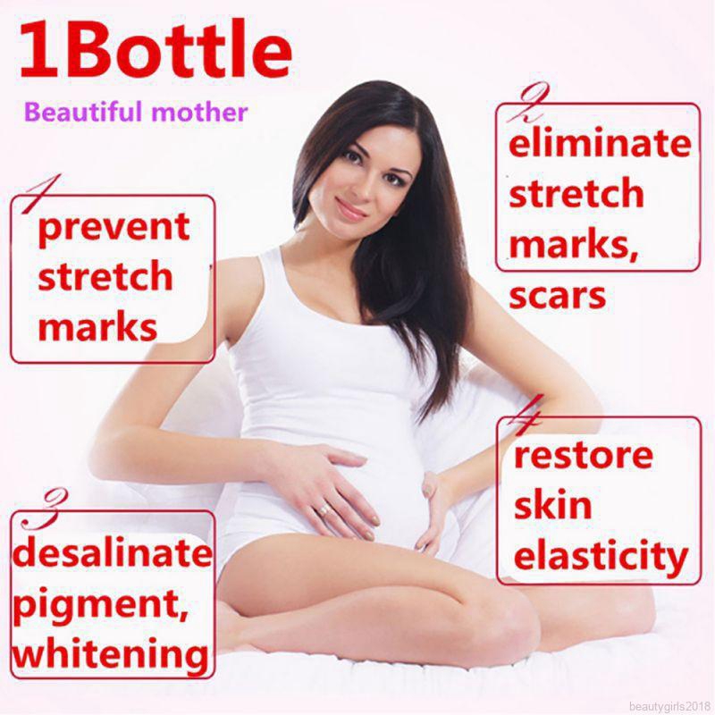 Afy Krim Perbaikan Stretch Mark Untuk Menghilangkan Stretch Mark 100g Shopee Indonesia