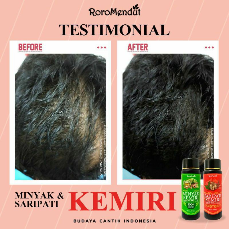 Minyak Kemiri & Saripati Kemiri Roro Mendut