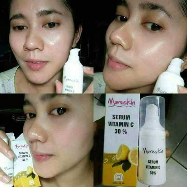 Serum vit C nasa/serum jerawat/flek hitam/glowing