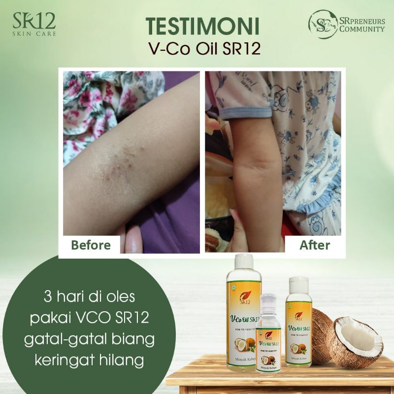 Vco Virgin Coconut Oil SR12 Original BPOM