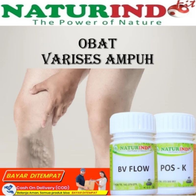 OBAT VARISES PARISES VERIKOKEL PALING AMPUH