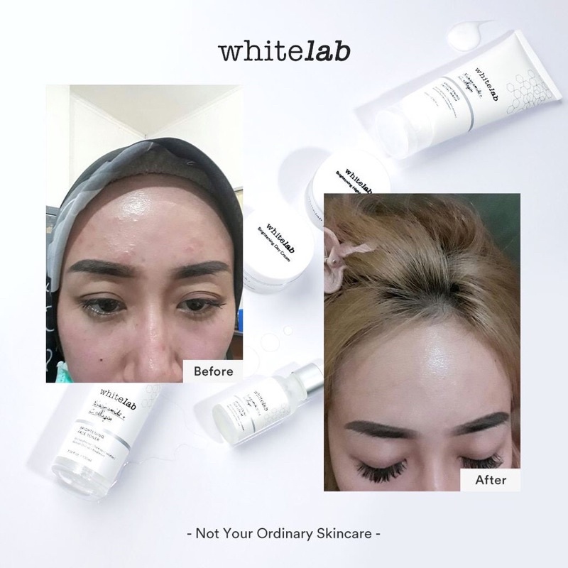 WHITELAB Brightening Paket Wajah Serum + Night Cream + Day Cream + Facewash + Toner