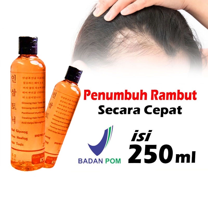 HOPE STORE  - RED GINGSENG HAIR TONIC ORIGINAL / Tonic Penumbuh Rambut dan Mencegah Kerontokkan