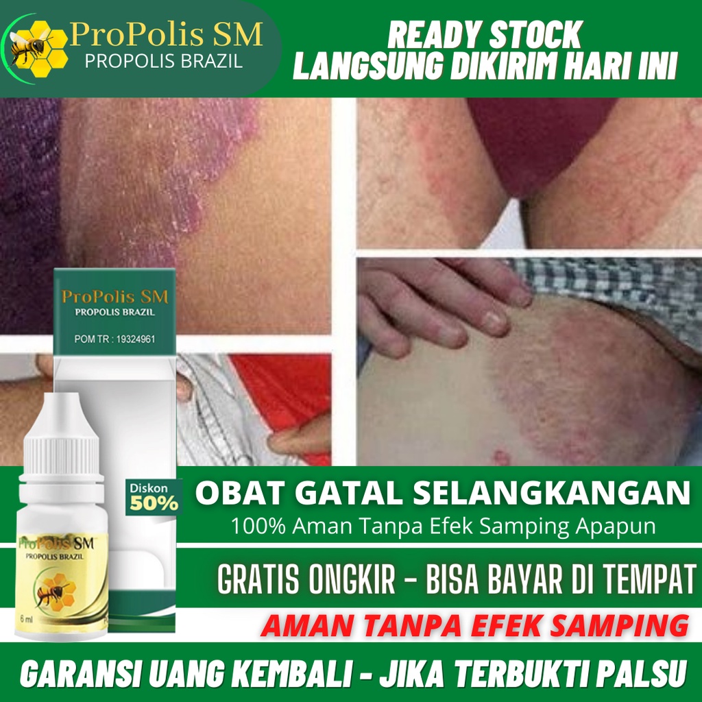 Obat Gatal Selangkangan, Salep Penghilang Gatal Selangkangan, Menghilangkan Bekas Hitam Diselangkang