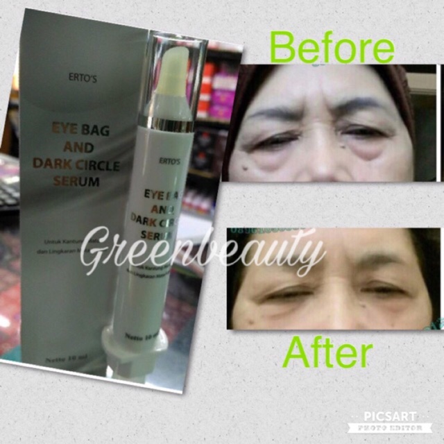 Ertos Eye Bag Dark Circle Serum Indonesia