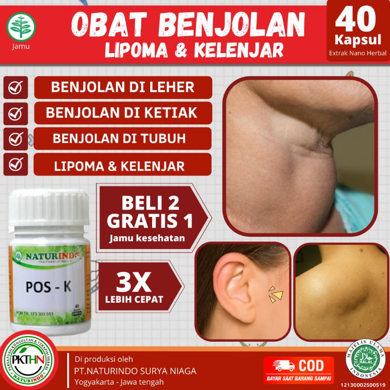 obat benjolan gondok uci uci lipoma benjolan di leher hipertiroid benjolan kista miom ketiakObat Benjolan Benjolan Di Leher Benjolan Payudara Benjolan Di Tangan Benjolan Lipoma Benjolan Kelenjar Benjolan Di Ketiak