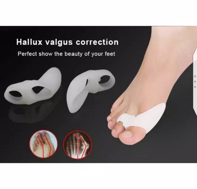 Ready Bunion Pemisah Korektor Jari Jempol Kaki Hallux  Valgus