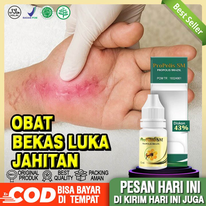 Obat Bekas Luka Jahitan, Bekas Jaitan Bernanah & Berair, Obat Pasca Operasi Sesar Bedah