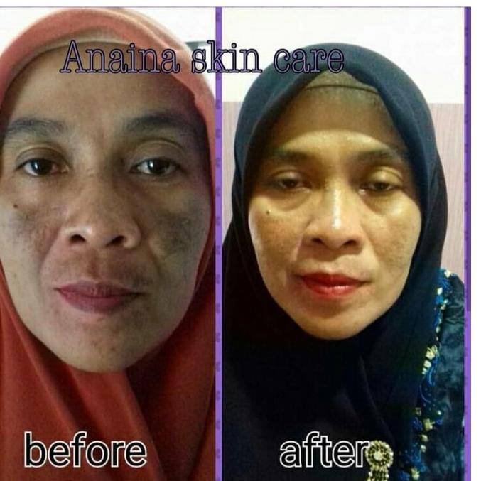 ☽ Cream Malam Anaina skincare NC 1 (untuk kulit kusam dan flek membandel) ㅵ