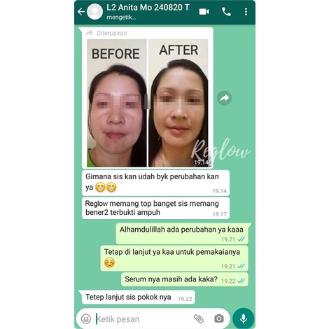 Cream REGLOW Untuk menghilangkan Flek Jerawat Kerutan-4
