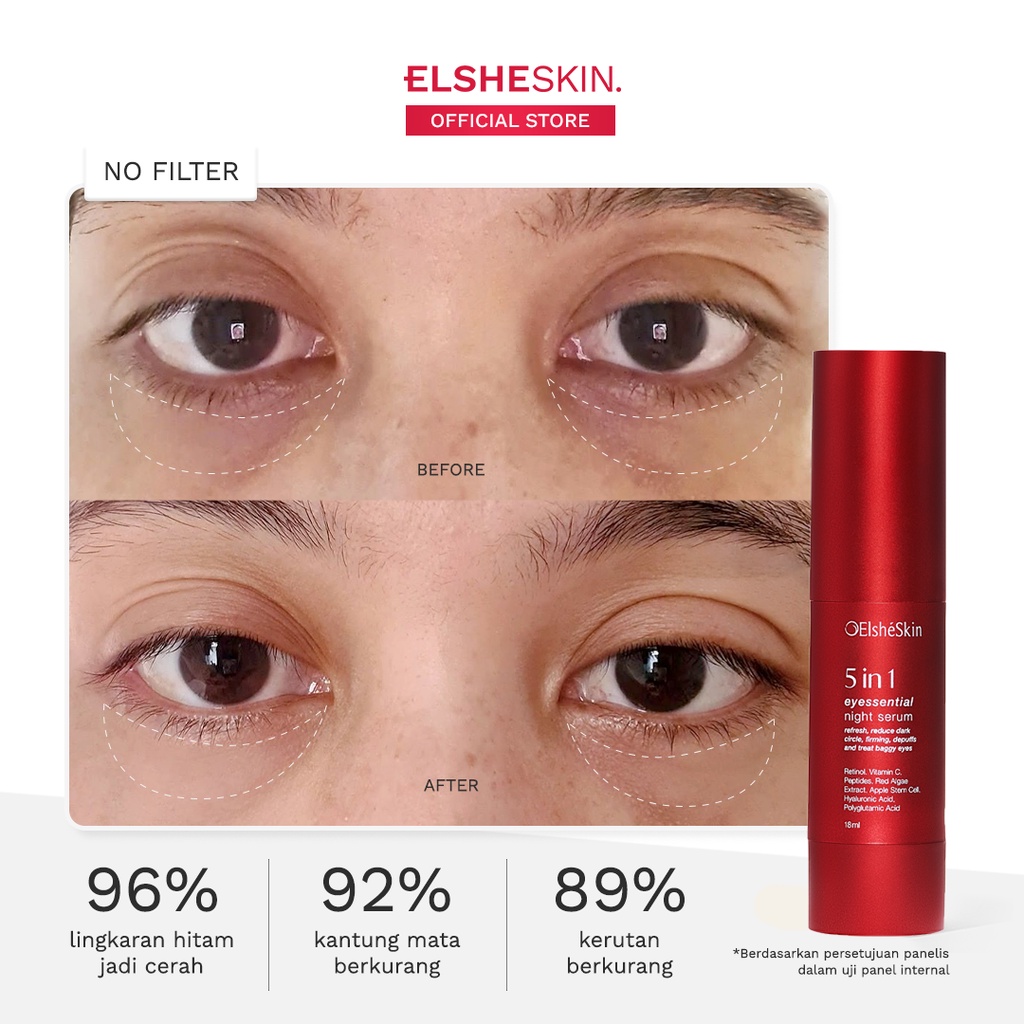 5 in 1 ElsheSkin Eyessential Night Serum - 18ml Retinol (7 Hari Cerahkan Mata Panda) - Eye Serum Kerutan-1