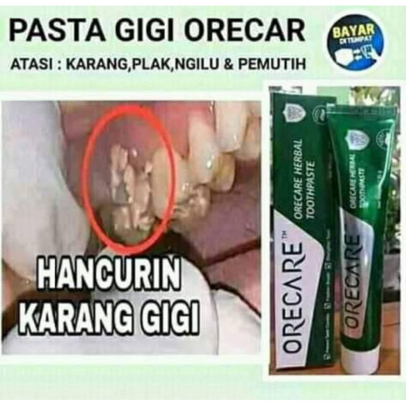 ODOL PENUMBUH & PEMUTIH GIGI. PENGHILANG KARANG GIGI ( BISA BAYAR DITEMPAT)