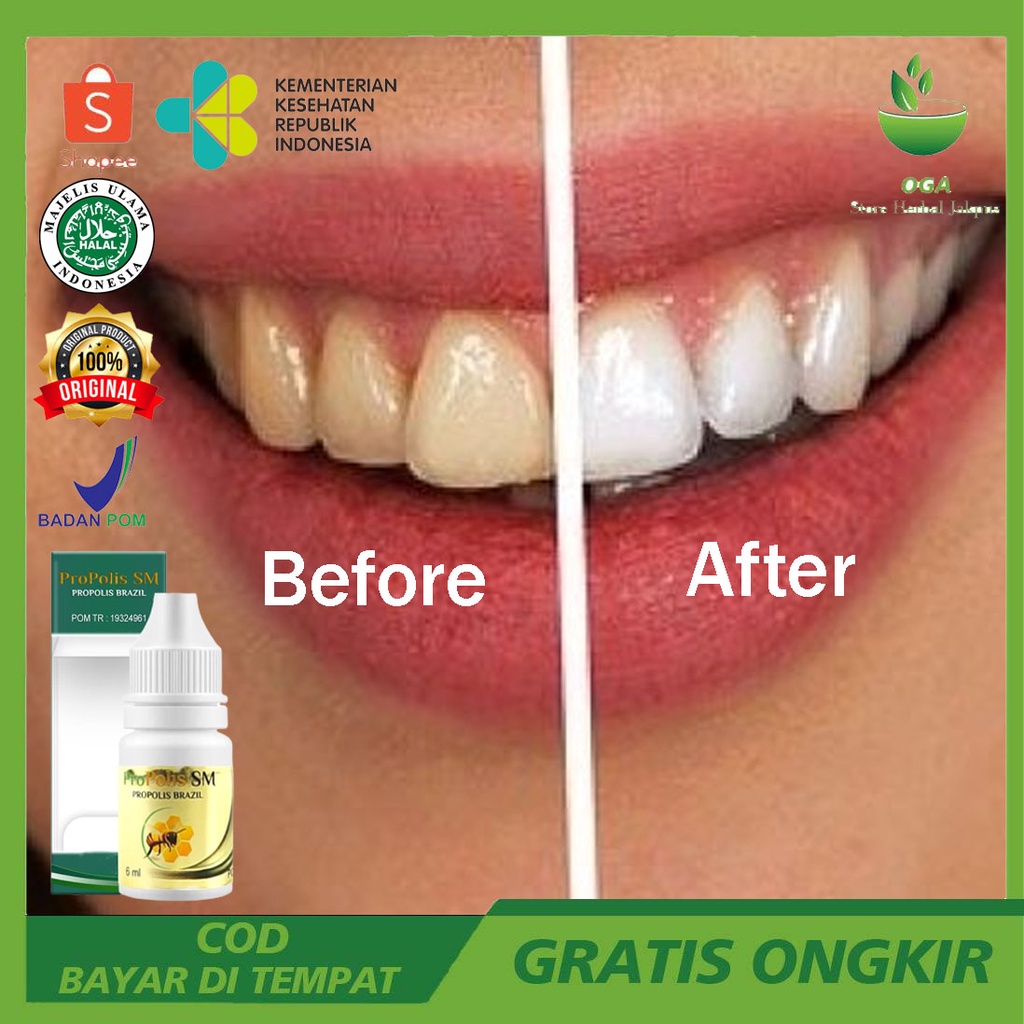 Super Whitening Obat Tetes Pemutih Gigi dan Penghilang Karang Gigi Propolis Original Pemutih Gigi