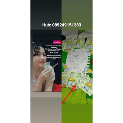 (COD) penghilang tahi lalat. BINAHONG (garansi uang kembali)