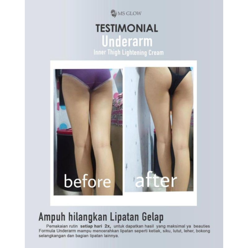 

UNDERARM PEMUTIH KETIAK PENCERAH LIPATAN MSGLOW ORIGINAL BPOM