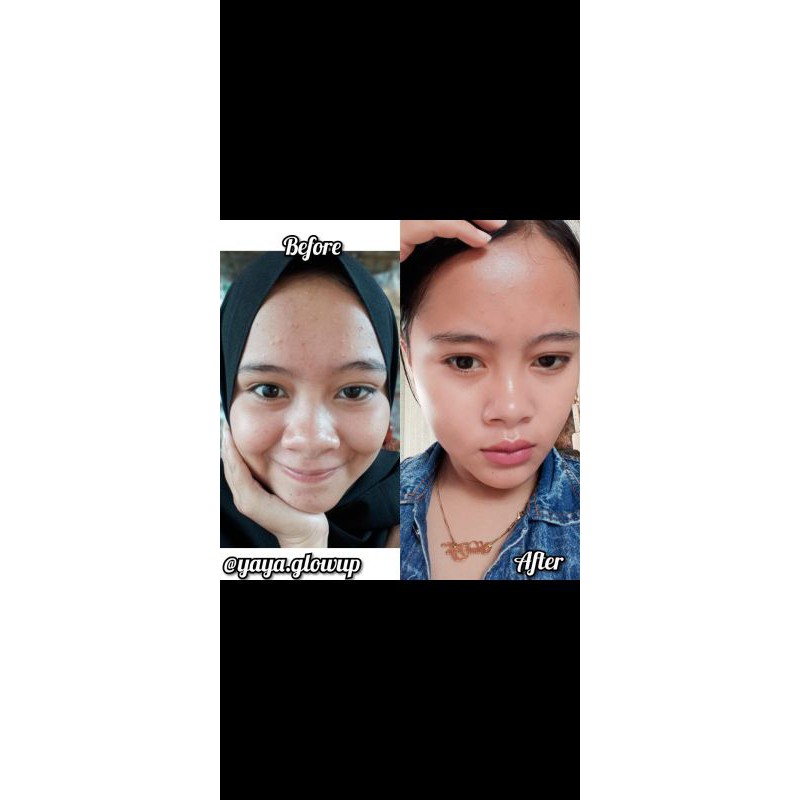 skincare Yaya glow up