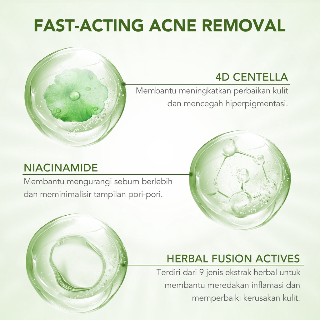 YOU AcnePlus Spot Care Acne Treatment | 4D Centella Asiatica Niacinamide Herbal Obat Jerawat