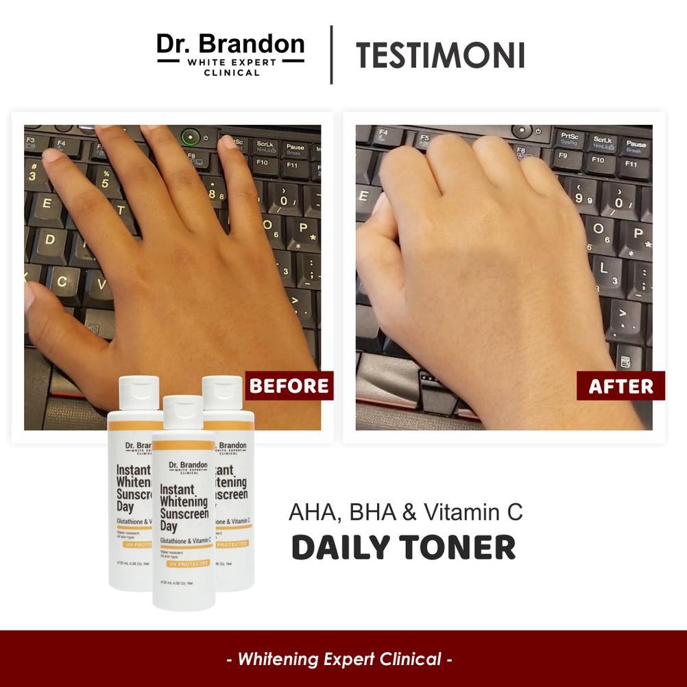 Buruan Beli ZLLQA Dr. Brandon Instant Whitening Sunscreen Day 99 Super Promo