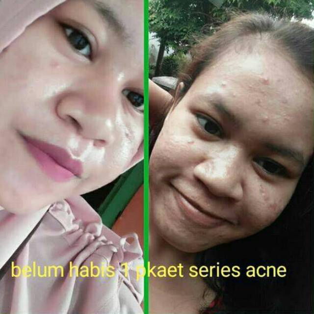 [BISA COD] BEBWHITE C SKINCARE / BBC