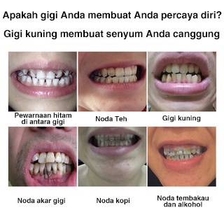 [COD]Pemutih Gigi Kuning Kerak Penghilang Karang Permanen Original Ampuh Teeth Whitening Menghapuskan plak gigi dan noda asap menghapuskan bau mulut Perawatan Mulut Menghilangkan Plak Serum Efektif Untuk Pemutihan Gigi 4.8