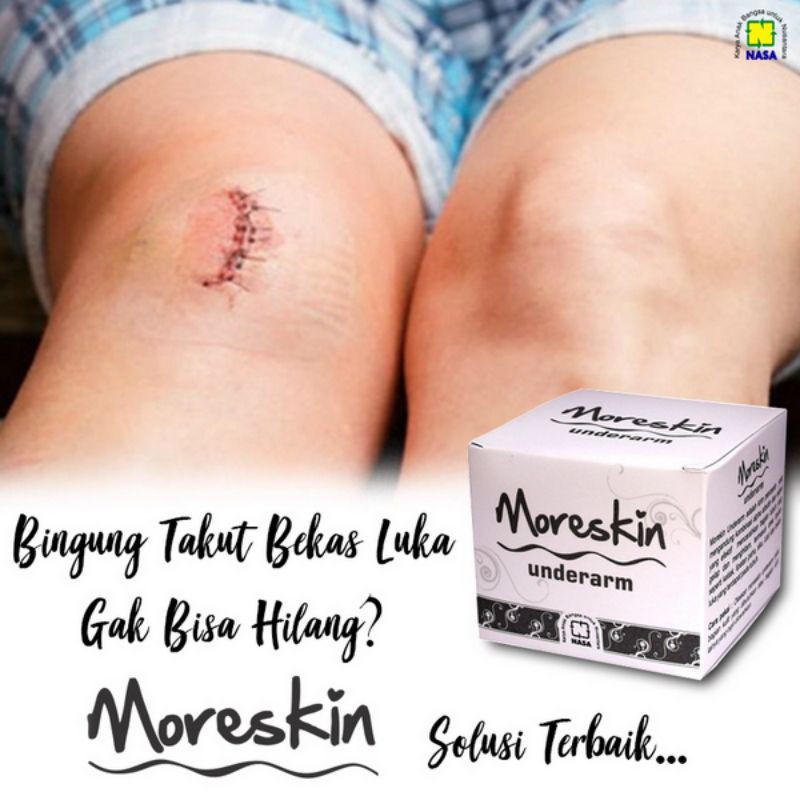 moreskin underarm