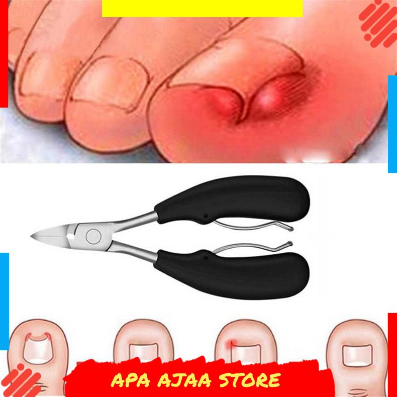 Paling Dicari ! Tegoni Gunting Kuku Jempol Kaki Anti Cantengan Toe Nail Clipper MZ-020