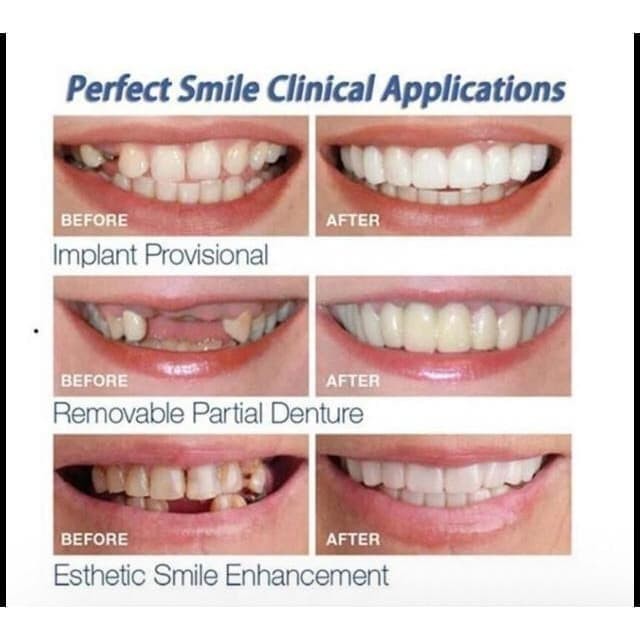 GARANSI 1 BULAN KERUSAKAN Senyum Indah ATC Perfect Smile ORI