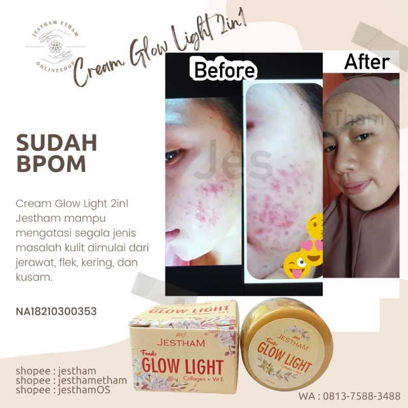 Cream Glow Light 2 in 1 Jestham untuk Flek, Milia