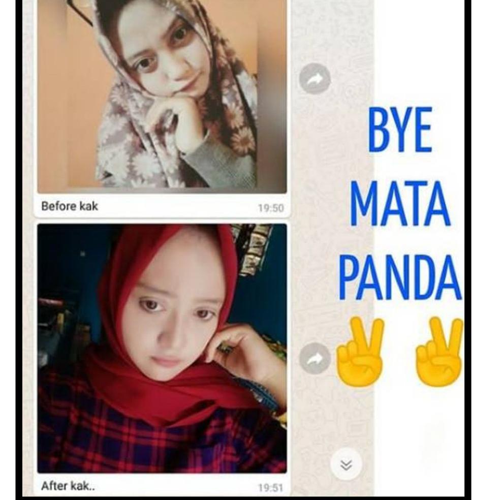 W2F4 ULTIMATE EYE GEL ORIGINAL BY NEBI /ULTIMATE EYE GEL BY NEBI EYE GEL /ULTIMATE EYE GELL ORIGINAL