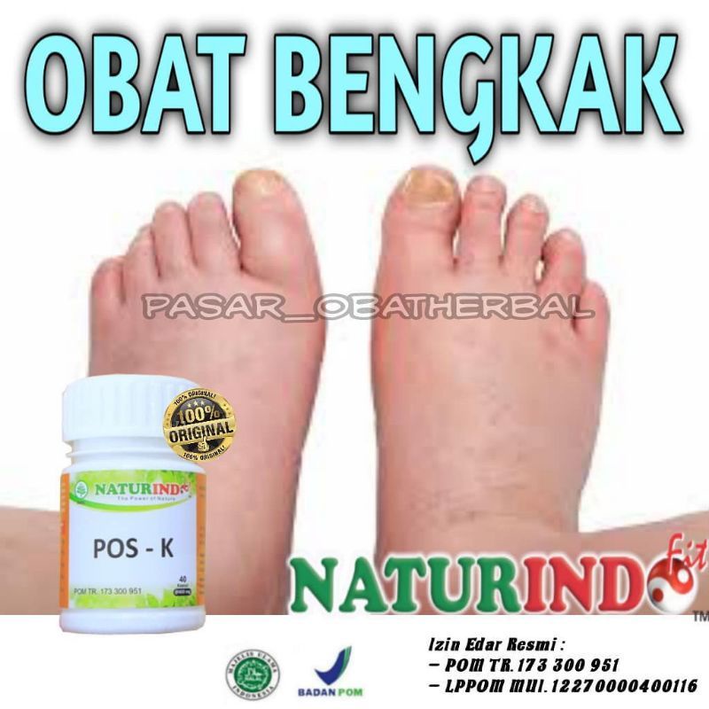 Herbal Obat Gondok Obat Kelenjar Tiroid Obat Benjolan Di Leher Obat Gondok Teroid POS K