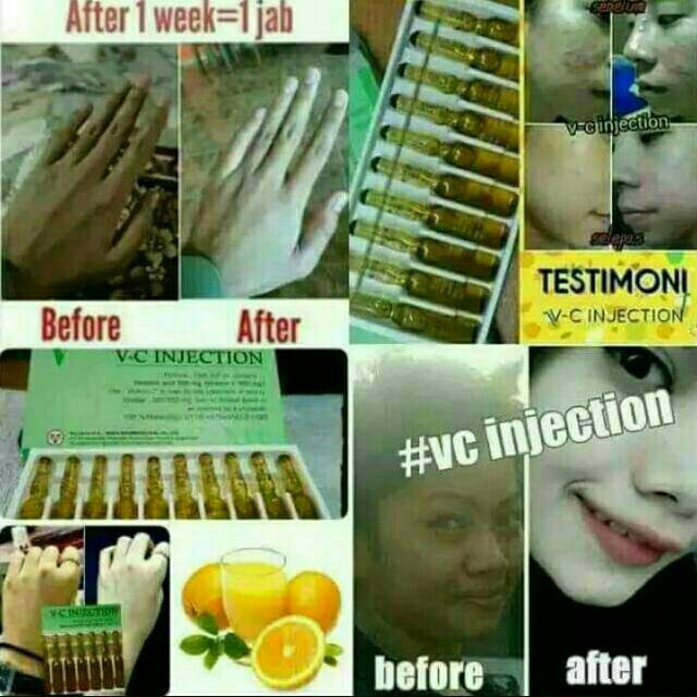 

Vc_injection